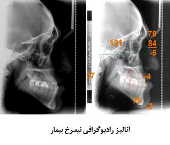 آنالیز رادیوگرافی نیمرخ بیمار