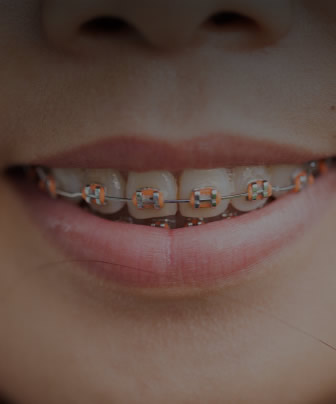 orthodontics 5