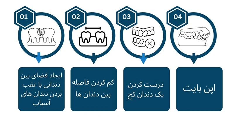 کاندیدای مناسب مینی اسکرو