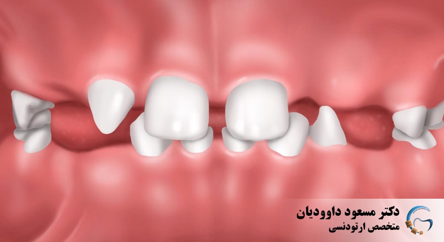 ارتودنسی-عقل نهفته