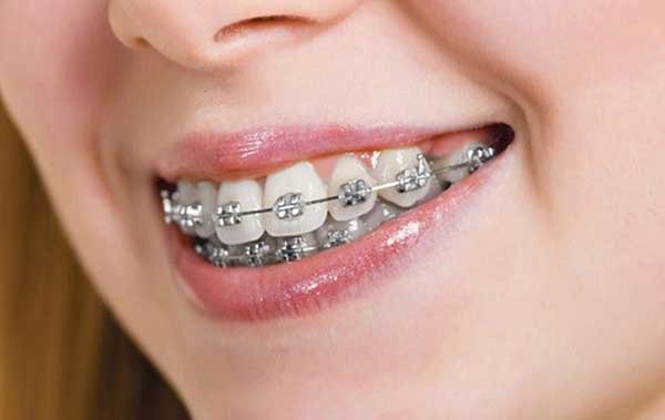 Orthodontic4