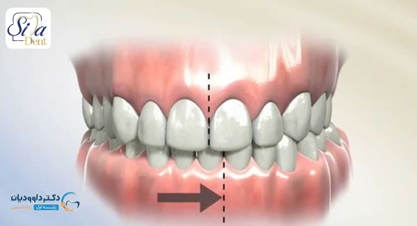 simadent dental midline 008