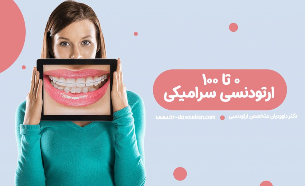 ارتودنسی سرامیکی چیست و چه مزایا و معایبی دارد 9 ارتودنسی سرامیکی چیست