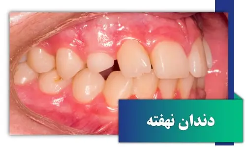 drdavoudian orthodontist impact1