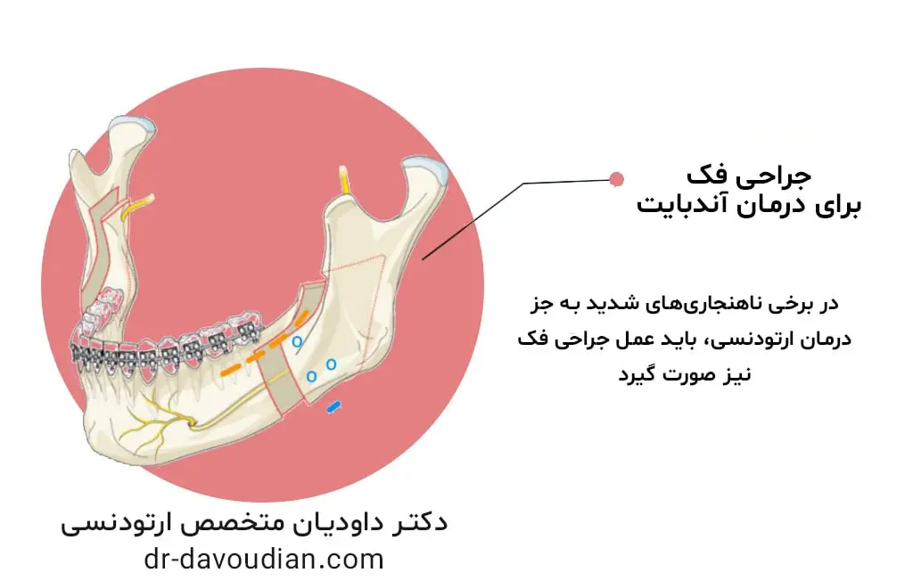 اینفوگرافیک جراحی فک و تاثیر آن در هزینه ارتودنسی دندان در سال 1403