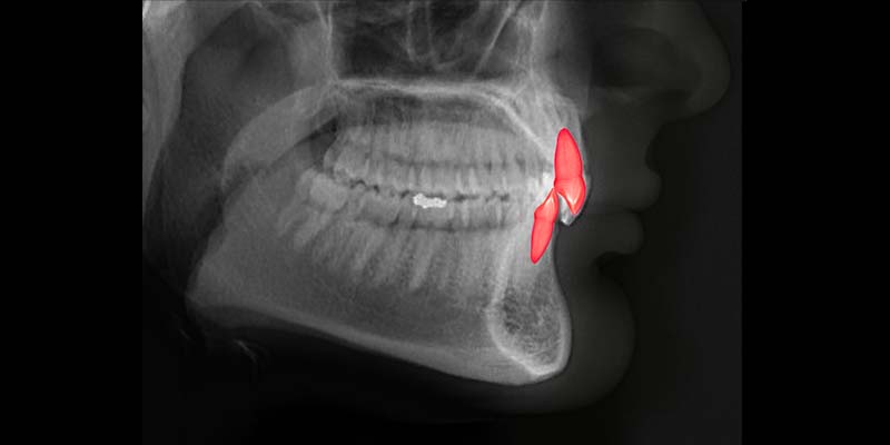 RadiographyHB