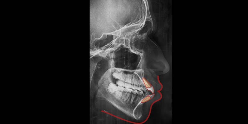radiologyAM 2