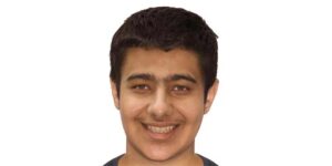 درمان عقب بودن فک پایین