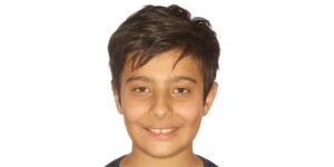 قبل از ارتودنسی دندان