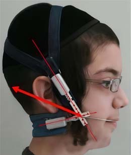 ترکیبی Combination Headgear 1