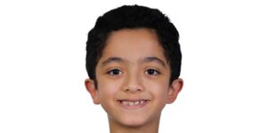 قبل از ارتودنسی دندان