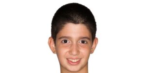 قبل از ارتودنسی دندان