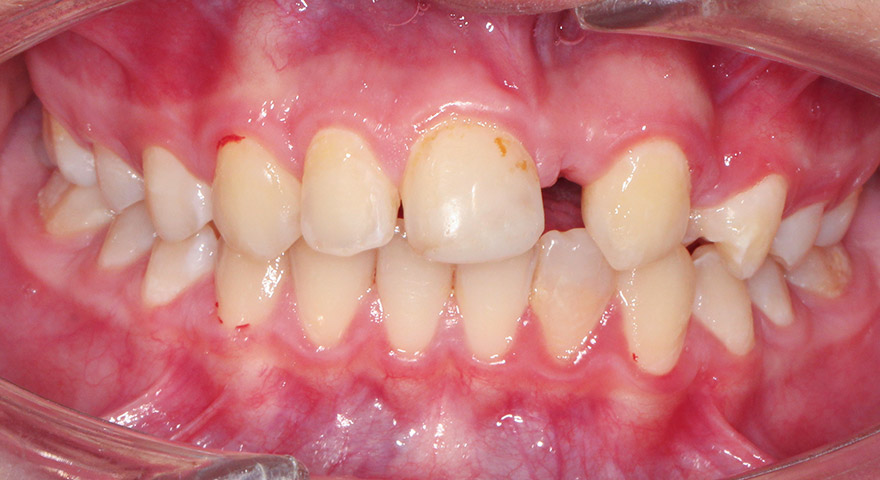 AM FTB
